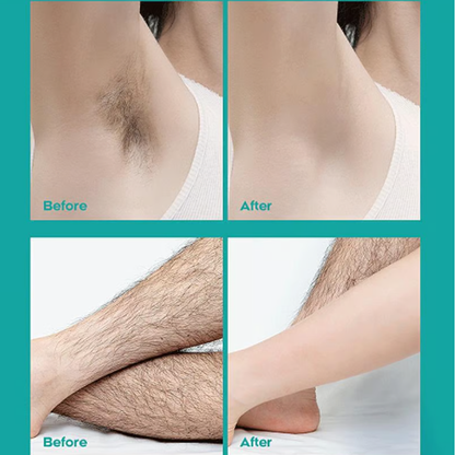 💎 -50% ON PAINLESS HAIR REMOVAL CREAM! 💎 Fast 8-Min Formula for Men & Women, Infused with Aloe & Vitamin E