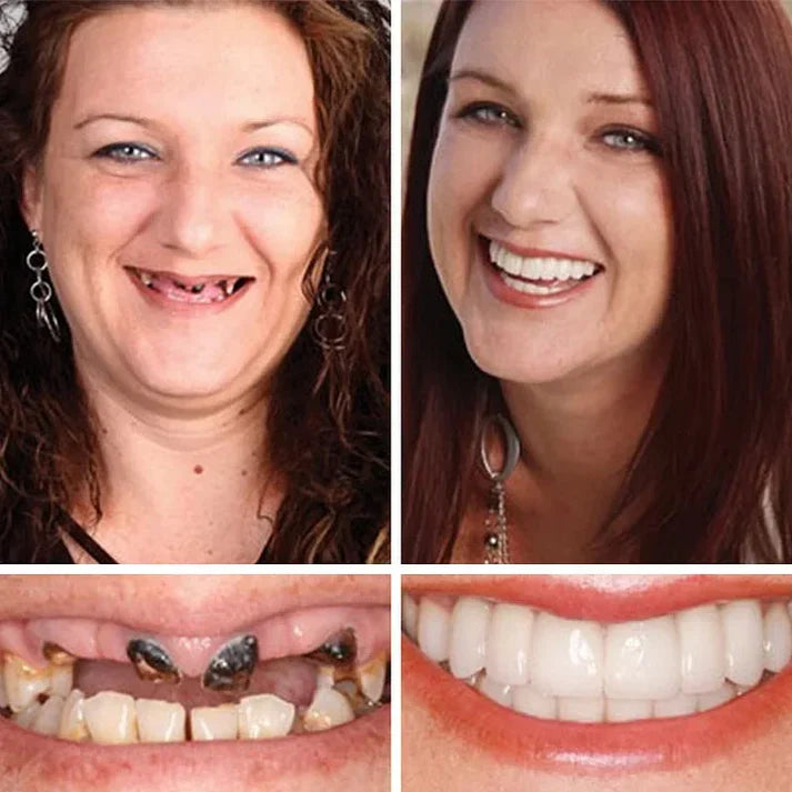 Offer ends today: 50% off! ⏰50% off! KLENIMORE™ Medical Grade, Strong Adhesion, Custom Fit