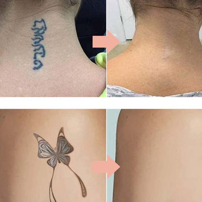 🔥 50% OFF · Gentle Effective Multi-Use Tattoo Fading Cream ✨